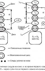 Книга Новый взгляд на остеохондроз: причины и лечение